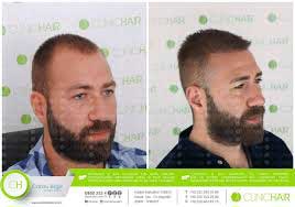 Clinic Hair Saç Ekim Merkezi