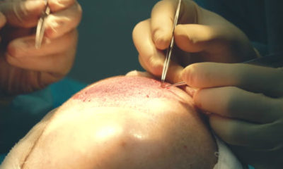 Saç Ekimi Fiyatları 2021