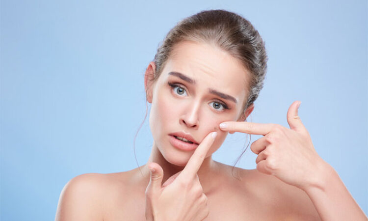 En İyi Siyah Nokta Maskesi ve Fiyatları